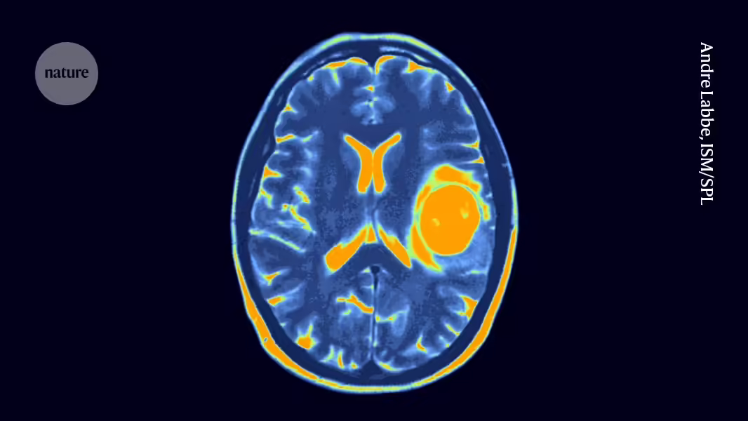 Unheilbar: Kinderhirntumor mit vielversprechender Immuntherapie